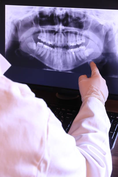 Best Emergency Root Canal Treatment in Greenup, KY