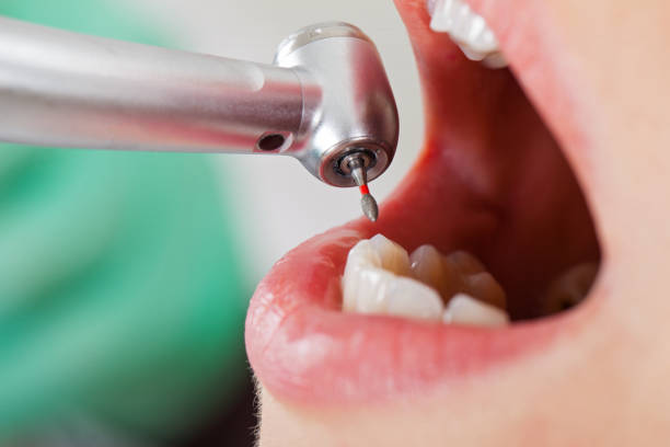 Best Emergency Treatment for Toothache in Greenup, KY